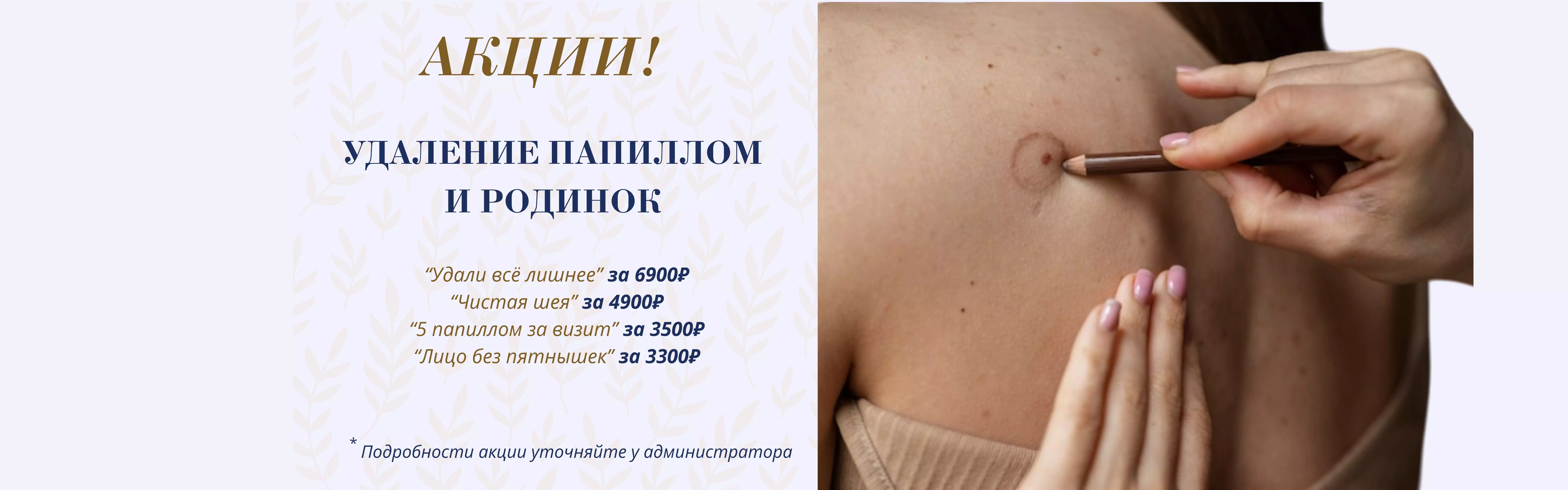 Удаление новообразований кожи на аппарате Сургитрон